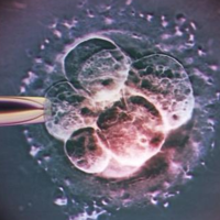 三代试管移植优质囊胚4ab后会有完全性葡萄胎的风险吗？