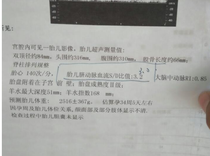 孕周越大sd值越小