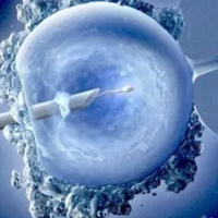 患有轻微巴氏腺囊肿的女性可以做三代试管胚胎移植吗？