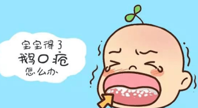 鹅口疮是婴幼儿常见的问题