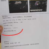 上一篇