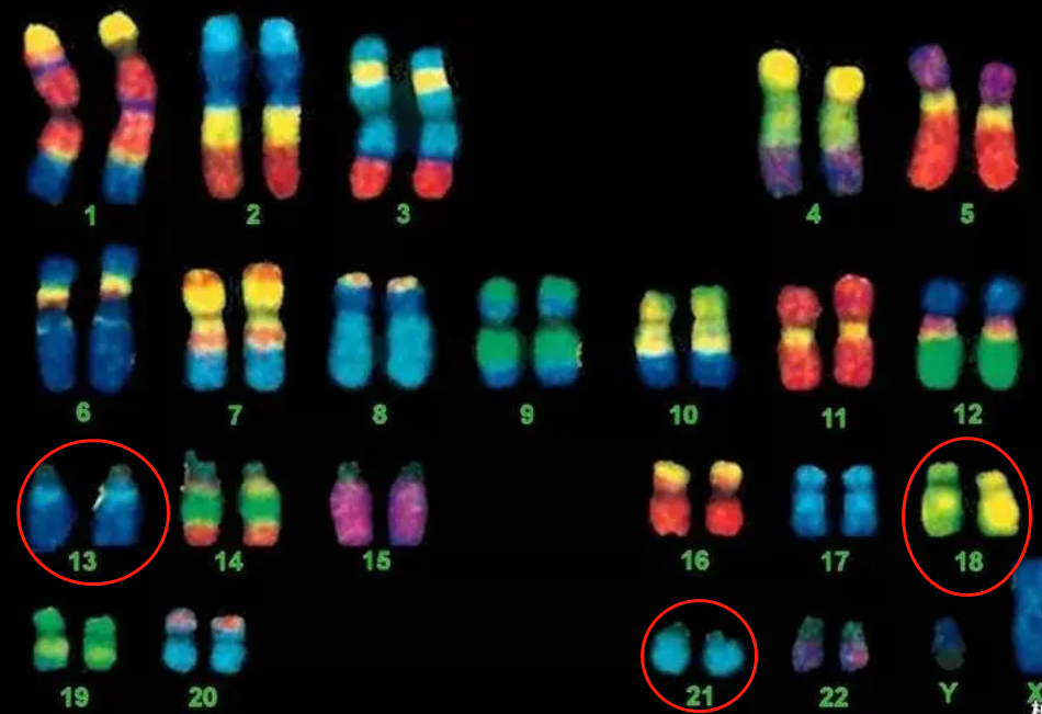 查21号18号13号染色体可以看肚子里的宝宝的性别吗？