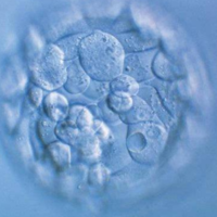 盘点反复移植失败的最主要原因，胚胎质量不好容易导致流产