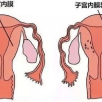 上一篇