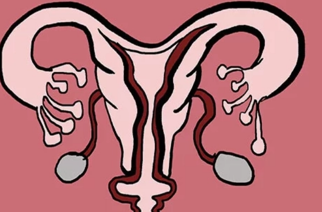 子宫内膜异位症会影响胚胎的着床能力