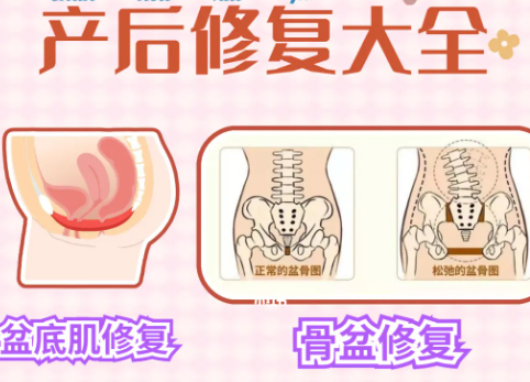 骨盆修复不专业会导致病情加重