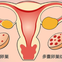 下一篇