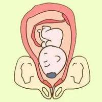孕晚期胎儿头盆不称在生产前可以用b超诊断吗？