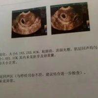 下一篇